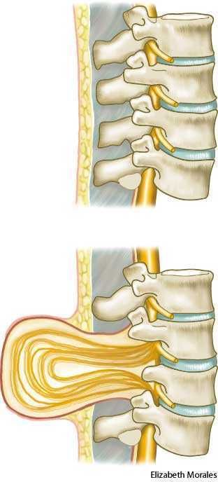 Medical Ultrasound, Spinal Column, Spina Bifida, Dictionary Definitions, Medical Anatomy, Neurological Disorders, Spinal Cord, Anatomy And Physiology, Folic Acid