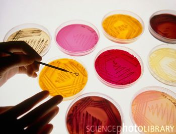 Petri dish bacterial cultures, picking a colony Microbiology Study, Petri Dishes, Petri Dish, Science Photos, Medical Laboratory, Microbiology, Buy Prints, Photo Library, Dark Forest