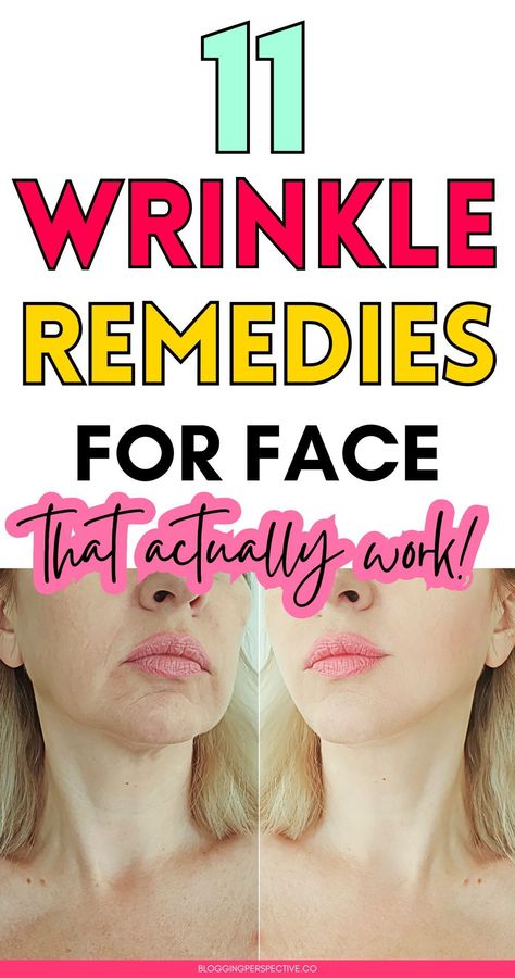 Wrinkle Remedies Face, 11 Wrinkles, Wrinkles Skin Care, Natural Wrinkle Remedies, Wrinkles Remedies, Wrinkles Remedies Face, Home Remedies For Wrinkles, Diy Wrinkles, Diy Masks