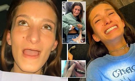 Woman who had ALL her teeth pulled out gets $30,000 smile makeover Tooth Pulled, Smile Makeover, Interesting Stories, Bad Kids, Feeding Tube, Dentures, Root Canal, Philadelphia Pennsylvania, The Verge