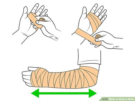 Sprained Wrist, Wrist Injury, Wrist Pain, How To Wrap, Athletic Trainer, Family Medicine, Carpal Tunnel, Wrist Wrap, Athletic Training