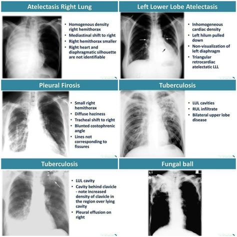 Radiology Schools, Medical Radiography, Radiology Student, Radiology Imaging, Interventional Radiology, Nursing School Essential, Medical School Life, Basic Anatomy And Physiology, Medical Surgical Nursing