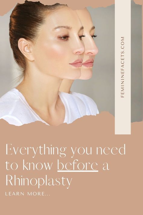 Rhinoplasty recovery tips, nose job timeline & what to know before getting a nose job (rhinoplasty) ♥ Before and After nose job | Rhinoplasty recovery tips| Nose job recovery Rhinoplasty Recovery Tips, Nose Job Before And After Rhinoplasty, Nose Jobs Before And After, Blephoraplasty Before And After, Rhinoplasty Before After, Rhinoplasty Recovery Timeline, Nose Job Before And After, Nose Job Recovery, Before And After Nose Job