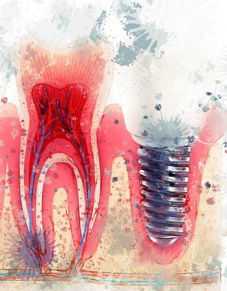 Conservative And Endodontics Art, Dental Art Creative, Dentistry Art Painting, Dental Drawings, Dental Painting, Dentistry Art, Dental Wall Art, Dental Pictures, Dental Wallpaper