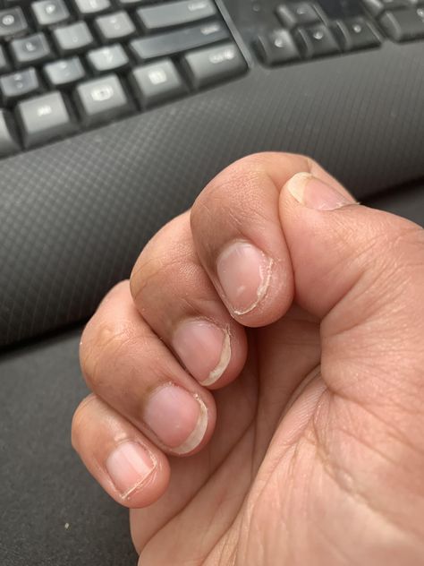 How to keep nails from breaking/peeling from the side? #nails #nailsart Ugly Nails, Henry Emily, Cracked Nails, Peeling Nails, Nail Picking, Rainbow Nail Art, Alex Winter, James Smith, Diy Nails At Home