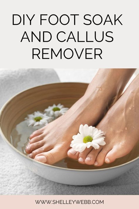 Callus Remover Diy, Natural Pedicure, Foot Soak For Calluses, Homemade Foot Soaks, Diy Foot Soak, Foot Soaks, Ice Spice, Callus Remover, Pregnant Diet