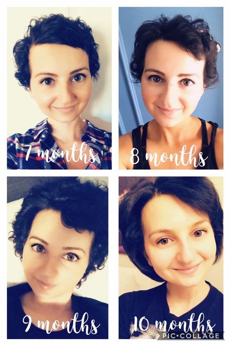 Let it Grow: Tips for Post-Chemo Hair Growth! Styling Hair After Chemo, Chemo Curls Short Styles, Chemo Curls Hairstyles, Tips For Growing Out Hair, Growing Hair After Chemo, One Year Hair Growth, Hair After Chemo, Chemo Curls, Hair Growth After Chemo