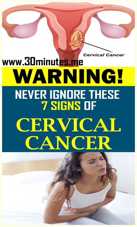 Splendid  piece of writing! Abnormal Cells, Health Signs, Types Of Cancers, Health Facts, Warning Signs, Fitness Motivation, Signs, Health, Fit Motivation