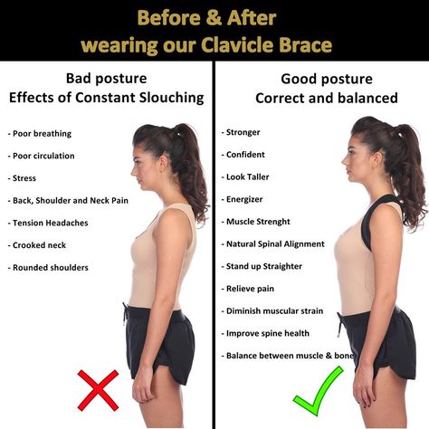 Why choose TURTLShield Back Posture Corrector? #back #posture #good #improve #better #life Back Posture, Back Posture Corrector, Shoulder Stand, Solve The Problem, Blood Sugar Diet, Spine Health, Poor Circulation, Tension Headache, Bad Posture