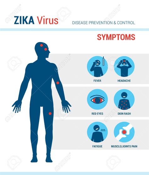 The Zika virus epidemic is still an ongoing topic. It is best to know the symptoms if planning on traveling to areas that the Zika virus is spreading to. Zika Virus, Disease Prevention, Headache, Disease, How To Plan