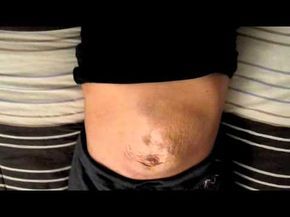 Diasis Recti Workout, Diasis Recti, 3rd Pregnancy, C Section Workout, Heidi Powell, Belly Binding, Healing Diastasis Recti, Diastasis Recti Exercises, Body After Baby