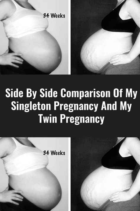 Side By Side Comparison Of My Singleton Pregnancy And My Twin Pregnancy Twin Belly, Twin Pregnancy Belly, Types Of Twins, Twin Tattoos, Parent Tattoos, Pregnancy Belly, Parents Quotes Funny, Polycystic Ovarian Syndrome, Newborn Twins