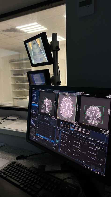 Radiology aesthetic, brain MRI Waktu Solat, Radiology Student, Radiology Technician, Medical School Life, Nurse Aesthetic, Medical Student Motivation, Med School Motivation, Career Vision Board, Medicine Student