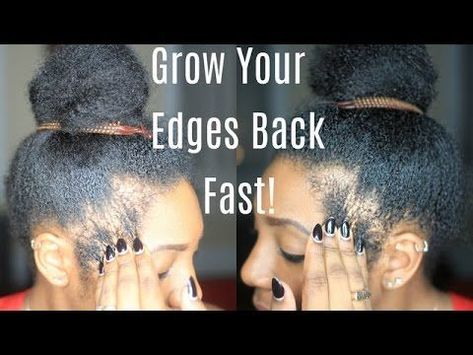 Hair | Grow Out Your Edges & Bald Spots FAST! [Video] - Black Hair Information Black Hair Growth, Thick Hair Remedies, Growing Healthy Hair, Edges Hair, How To Grow Natural Hair, Bald Spot, Bald Hair, Regrow Hair, Pelo Afro