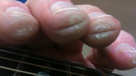 the amount of strain on your fingers from playing guitar can cause unsightly calluses. the time it takes to develop significant callouses is around 5 to 6 days. Guitar Calluses, Guitar Hands, Obsessed Artist, Calloused Hands, Guitar Fingers, Dimebag Darrell, Got Characters, Playing Guitar, It Takes