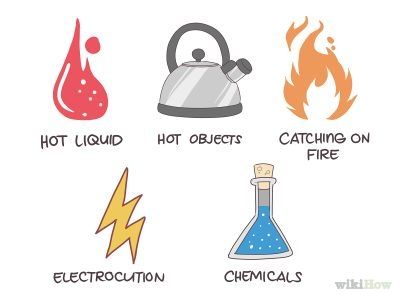 How to Know What Degree a Burn Is -- via wikiHow.com Types Of Burns, 2nd Degree Burns, Burn Care, Advanced Cardiac Life Support, Degree Burns, Family Nurse Practitioner, Critical Care Nursing, Master Of Science, Emergency Medicine