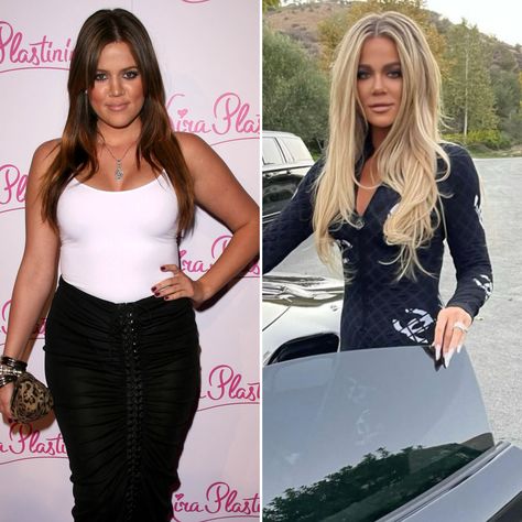 Khloe Kardashian Transformation, Khloe Kardashian Plastic Surgery, Kardashian Plastic Surgery, Khloe Kardashian, Plastic Surgery, Then And Now, Leather Skirt