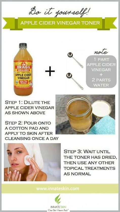 Vitamins For Clear Skin, Apple Cider Vinegar Toner, Apple Cider Vinegar Acne, Apple Cider Vinegar Face, Braggs Apple Cider, Apple Cider Vinegar Remedies, Skin Care Routine For 20s, Vitamins For Skin, Sensitive Skin Care