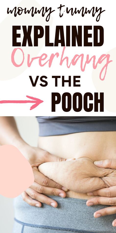 Mommy Tummy Explained: Overhang Vs. The Pooch Postpartum Pooch, Get Rid Of Mommy Belly, Losing Stomach Pooch, How To Get Rid Of Mom Pooch, Losing The Mommy Pooch, Stomach Pooch Outfit, Lose The Pooch, Lose Mommy Pooch Fast, How To Get Rid Of Mommy Pouch