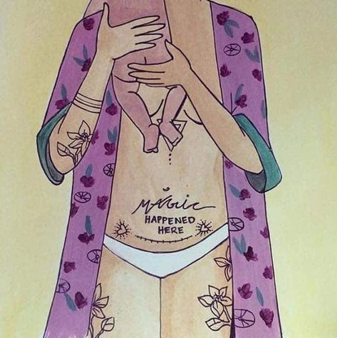 c-section ❤ C Section Tattoo, Mommy Inspiration, Pregnancy Art, Mother Art, Mom Life Quotes, Quotes About Motherhood, Mom Art, C Section, Body Love