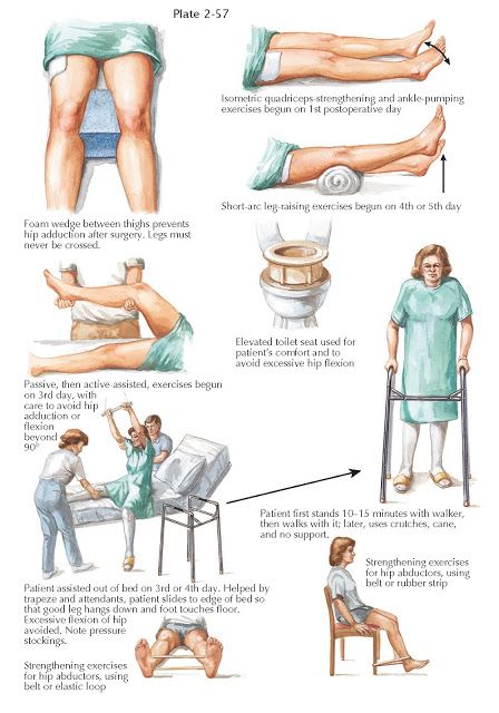 REHABILITATION AFTER TOTAL HIP REPLACEMENT Total Hip Precautions Handout, Hip Rehabilitation Exercises, Torn Labrum Hip Exercises, Total Hip Surgery, Arthroscopic Hip Surgery, Hip Labral Tear Surgery Recovery, Exercises After Hip Surgery, Hip Precautions, Preparing For Hip Surgery