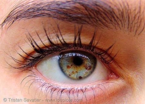 Partial Heterochromia, Eye Freckles, Eye Iris, Rare Eyes, Pinterest Uk, Colored Eye Contacts, Realistic Eye Drawing, Beautiful Eyes Color, Rank 1