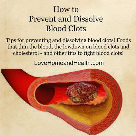 Blood Clots - Blood Thinning Foods, Grape Juice, Natural Health Remedies, Lower Cholesterol, Natural Home Remedies, Health Info, Heart Health, Love Home, Natural Medicine