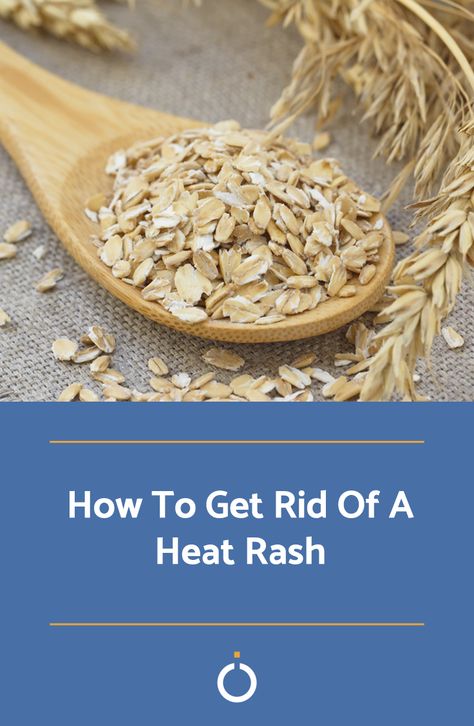 Prickly Heat Rash Remedies, How To Get Rid Of Heat Rash, Heat Rash Remedy For Adults, Remedies For Heat Rash, Heat Rash On Face, Heat Rash Remedy, Baby Heat Rash, Home Remedies For Rashes, Prickly Heat Rash