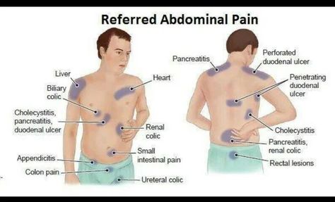 Referred pain examples, Causes of neuropathic pain and Pain control mechanisms Cerebrum Function, Kidney Pain, Referred Pain, Angina Pectoris, Peripheral Nerve, Abdominal Pain, Ayurveda, Medicine