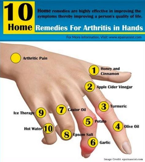 Joints Pain Remedy, Arthritic Pain, Natural Therapy, Quality Of Life, Natural Home, Natural Home Remedies, Natural Medicine, Health Remedies, Home Remedies