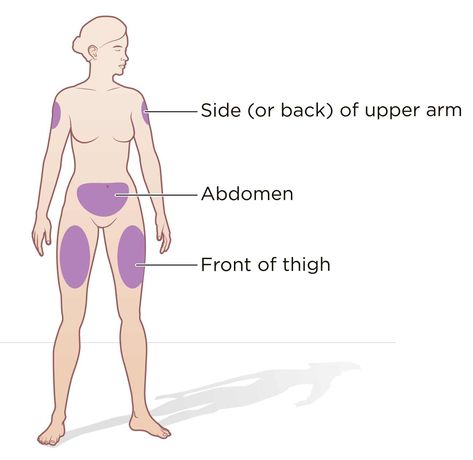 Injection Sites Cheat Sheet, Subcutaneous Injection Sites, Intramuscular Injections, Insulin Injection Sites, Types Of Injection, Charting For Nurses, Vitamin Injections, Injection Sites, Nursing Student Humor