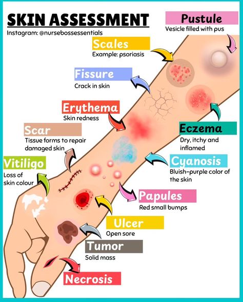 Skin Lesions, Nursing School Essential, Nurse Study, Medical School Life, Nursing School Motivation, Nurse Study Notes, Basic Anatomy And Physiology, Nursing Student Tips, Biology Facts