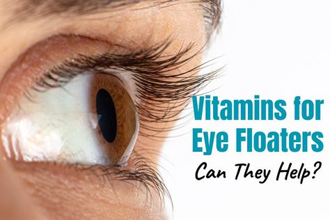 vitamins for eye floaters Eye Floaters Remedies, Floaters In The Eye, What Causes Eye Floaters, Eye Health Facts, Eye Health Remedies, Eye Floaters Causes, Eye Health Food, Eye Floaters, Eye Vitamins