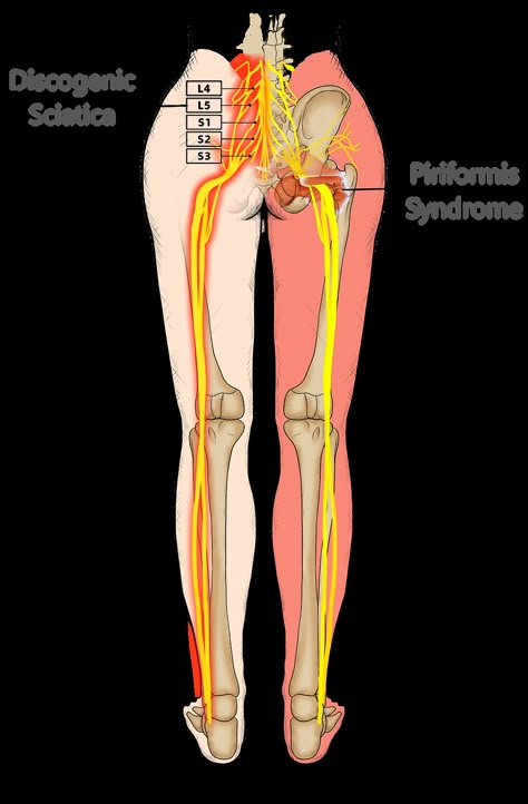 Exercise For Sciatic Nerve Pain, Piriformis Syndrome Symptoms, Sciatic Nerve Exercises, Spinal Degeneration, Sciatic Nerve Pain Relief, Nurse Skills, Piriformis Muscle, Piriformis Syndrome, Sciatica Pain Relief