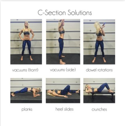 C-SECTION SOLUTIONS: HOW TO ELIMINATE THE POOCH AND REDUCE THE “TUMMY SHELF” C Section Shelf, C Section Belly, After C Section Workout, Postpartum Exercises, Post C Section, C Section Workout, Heidi Powell, Pooch Workout, Stomach Fat Workout