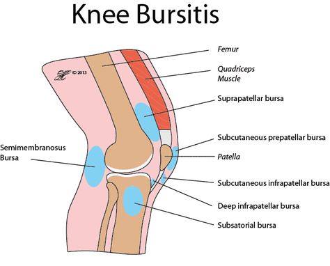 Pain around the Knee (Inflammed Bursitis) Bursitis Knee, Common Knee Injuries, Parts Of The Knee, Knee Pain Relief Exercises, Core Exercises For Women, Swollen Knee, Joints Pain Remedy, Knee Strengthening Exercises, How To Strengthen Knees