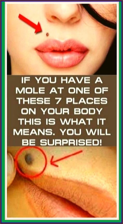 IF YOU HAVE A MOLE AT ONE OF THESE 7 PLACES ON YOUR BODY THIS IS WHAT IT MEANS. YOU WILL BE SURPRISED Mole Meaning, Women Health Care, Word Online, School Communication, Health Planner, Health Facts, Natural Treatments, Diet Tips, Mole