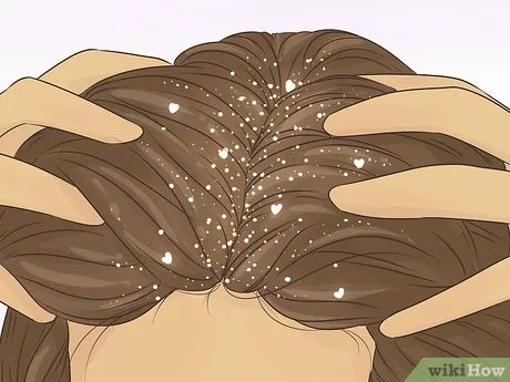 Space Buns Glitter Roots, Hairstyles With Glitter, Glitter In Hair, Braids With Glitter, Glitter Roots Hair, Glitter Hairstyles, Hair Down Styles, Glitter Roots, Diy Hairstyle