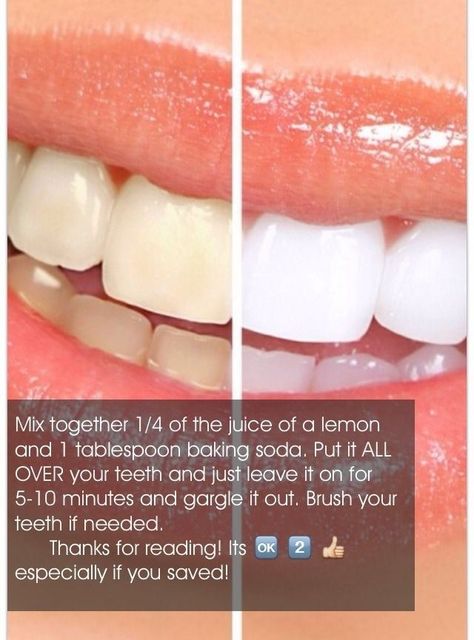 White Teeth Tips, Brighten Teeth, Teeth Whitening Homemade, Teeth Whitening Remedies, Teeth Whitening Diy, Resep Diet, Beauty Tips For Glowing Skin, Clear Skin Tips, Natural Teeth Whitening