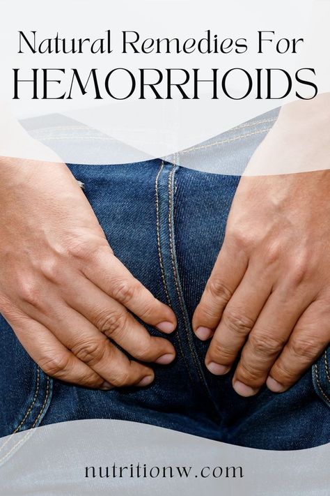 From treating hemorrhoids flare ups to preventing them before they happen, we have the best natural remedies here. Natural Hemorrhoid Remedy, Hemorrhoid Remedies, Medical Conditions, Home Remedies, Natural Remedies, Health