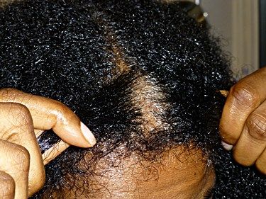 How to treat dry scalp in African American hair.  http://www.dryscalpgone.com/how-to-treat-dry-scalp-in-african-american-hair/ How To Treat Dry Scalp, African Braids Hairstyles Pictures, Thick Hair Remedies, Organic Hair Care, American Hairstyles, Hair Thickening, Dry Scalp, Organic Hair, Brittle Hair