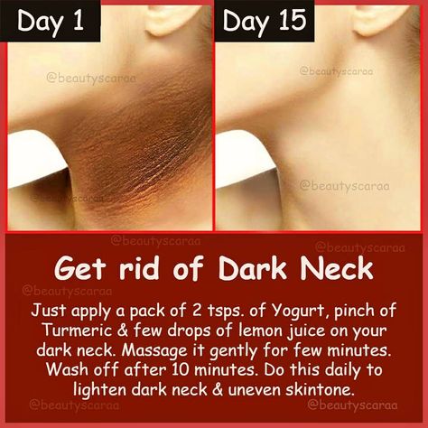 How To Get Rid Of Dark Neck At Home, How To Get Rid Of Dark Neck, Remove Neck Darkness, Get Rid Of Dark Neck, Turmeric For Skin, Dark Neck, Skin Care Home Remedies, Natural Face Cleanser, Tips For Happy Life