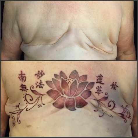 Decorative Mastectomy Tattoos – Amy Black Tattoos Flat After Mastectomy, Mastectomy Tattoo, Breast Surgery, Black Artists, Get A Tattoo, Lotus Flower Tattoo, Black Tattoos, Tattoo Artists, Flower Tattoo