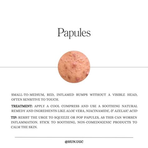 𝙨𝙬𝙞𝙥𝙚 & 𝙨𝙖𝙫𝙚 ☁️ acne can be frustrating, but understanding the different types and how to treat them can make a big difference. which type have you struggled with the most? let me know in the comments below ⬇️ from papules to cystic acne, there are both natural ways and right ingredients to heal your skin. so, let's tackle this together and get you on the right path to clearer skin 👇🏻 🤍 head to yesstyle now, and save both your money and skin with these products: ○ ma:nyo - pure cleansing... Papules Acne, On The Right Path, Azelaic Acid, Clearer Skin, Cystic Acne, Natural Remedies, Different Types, Aloe Vera, Let Me