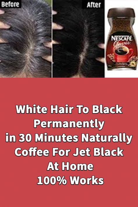 You will soon get rid of gray hair and get dark hair quickly using this natural formula. Click on the image to view Gray Hair Remedies Get Rid Of, How To Remove White Hair Naturally, Natural Hair Dye Ideas For Dark Hair, How To Cover Gray Hair Naturally, How To Reduce Grey Hair Natural, Shampoo To Cover Gray Hair, How To Get Rid Of Gray Hair Naturally, Grey Hair Remedies How To Get Rid, How To Get Rid Of Grey Hair