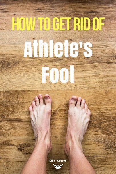 Itchy Feet Remedy, Athletes Foot, Natural Home Remedies, Natural Home, Health Remedies, Creative Gifts, Home Remedies, Natural Remedies, Skin