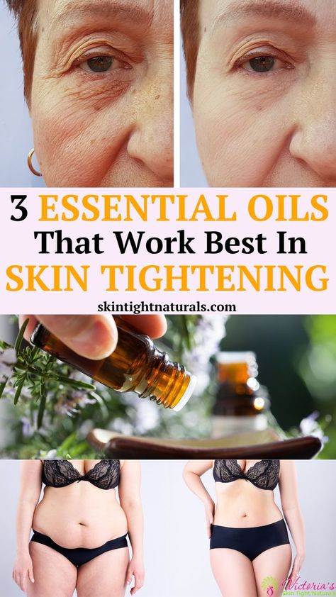 Do you have loose sagging skin on your face and body? Loose, sagging skin can be hard to get rid of even with a healthy lifestyle. Essential oils have been proven to be effective for smoothing out fine lines and wrinkles and firming your skin. I used a few key essential oils to tighten my skin during and after my 60-pound weight loss. Find out how I used them and how you can get the same results! #skintightening #howtotightenlooseskin #looseskin Tighten Loose Skin, Tighten Skin, Essential Oils For Skin, Saggy Skin, Best Essential Oils, Loose Skin, Best Oils, Sagging Skin, Essential Oil Recipes