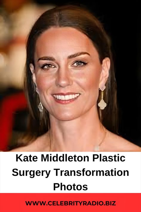 Kate Middleton Plastic Surgery Transformation Photos Botched Plastic Surgeries, Cameron Diaz Plastic Surgery, Barry Manilow Plastic Surgery, Robin Mcgraw Plastic Surgery, Melanie Griffith Plastic Surgery, Sandra Bullock Plastic Surgery, Marie Osmond Plastic Surgery, Angelina Jolie Plastic Surgery, Kendall Jenner Plastic Surgery