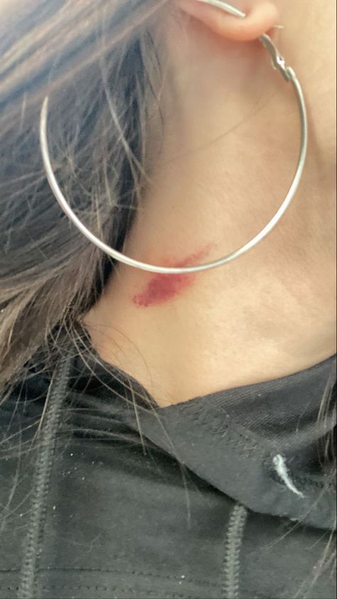 Hickies Neck, Best Nature Images, Love Bites, Snap Friends, Photos Tumblr, Mood Instagram, Girly Pictures, Cute Selfie Ideas