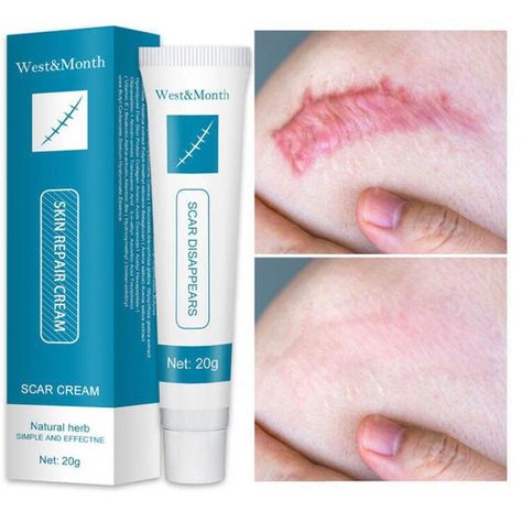 #affiliate Pin on Skin Care Smooth Skin Body, Top Rated Skin Care Products, Acne Scar Removal Cream, Skin Repair Cream, Scar Removal Cream, Nail Infection, Scar Cream, Tanning Products, Acne Scar